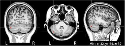 Theta burst stimulation over left cerebellum does not modulate auditory feedback control of vocal production